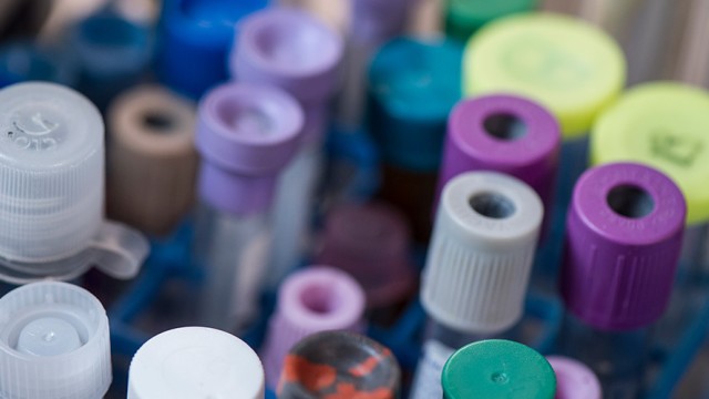Tops over several different kinds of test tubes