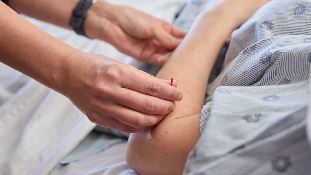 Hands on a patient's arm doing acupunture