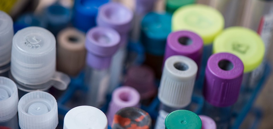 Tops over several different kinds of test tubes