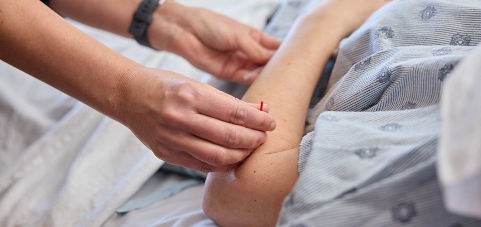 Hands on a patient's arm doing acupunture