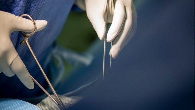 Two hands holding surgical instruments during a procedure