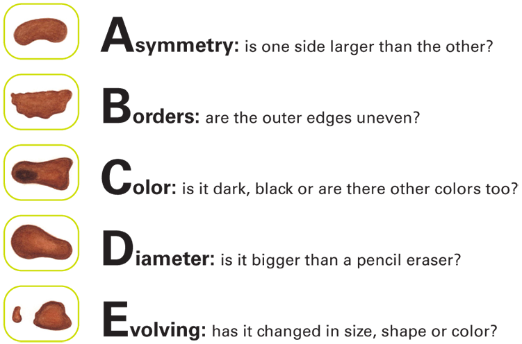 ABCDE Graphic800x no white space