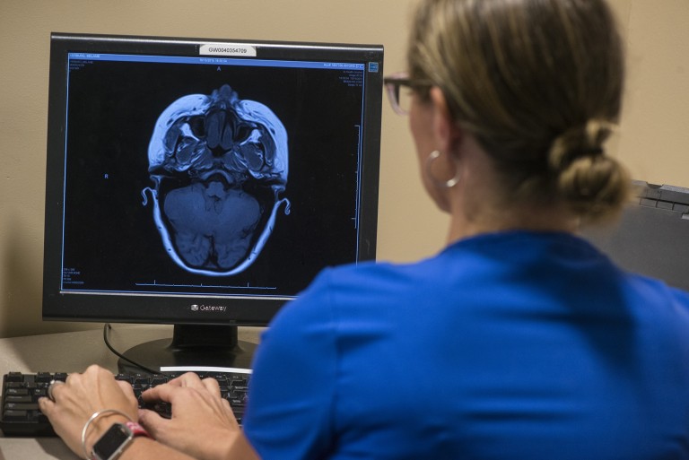 Medical person looking at a brain scan on the computer